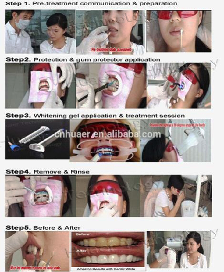 Two Patients Use Pro Teeth Whitening Kit