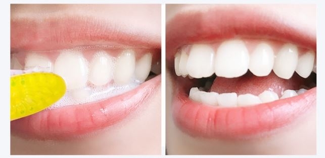 Non Peroxide Whitening